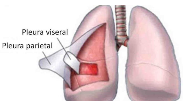 Gambar 9. Paru-paru dengan lapisan pleura